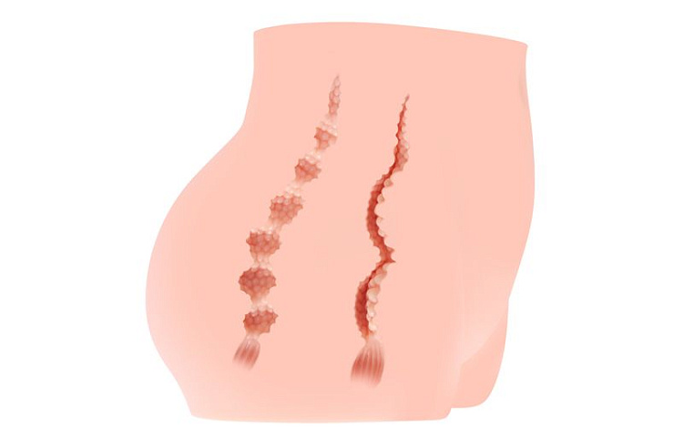 Мастурбатор-полуторс Cherry с вибрацией и двумя любовными тоннелями